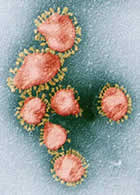 SARS virus